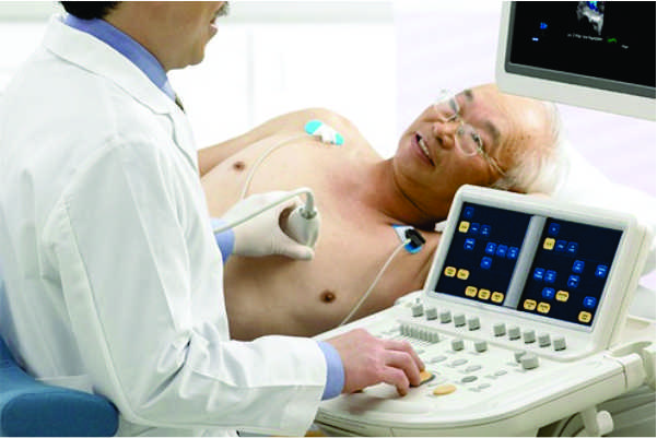 ECODOPPLERCARDIOGRAMA