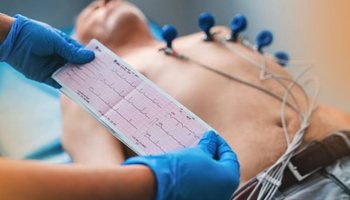 ELETROCARDIOGRAMA