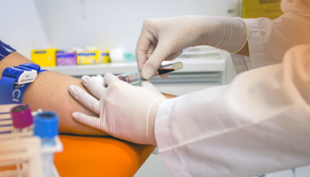 EXAMES LABORATORIAIS
